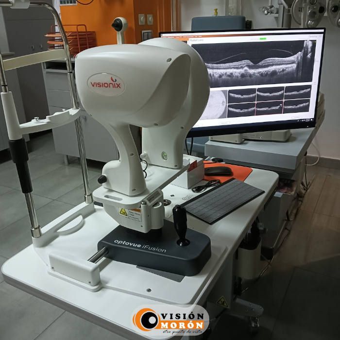 Retinografo en Visión Morón