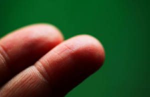 Colocación de Lentes de Contacto