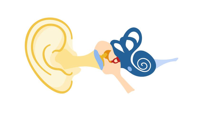 Clases de audífonos