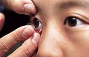 Colocación de Lentes de Contacto
